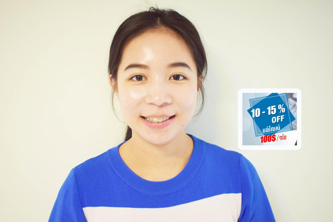 https://admin.realteethclinic.com/uploads/tes_10_1617332a54.jpeg